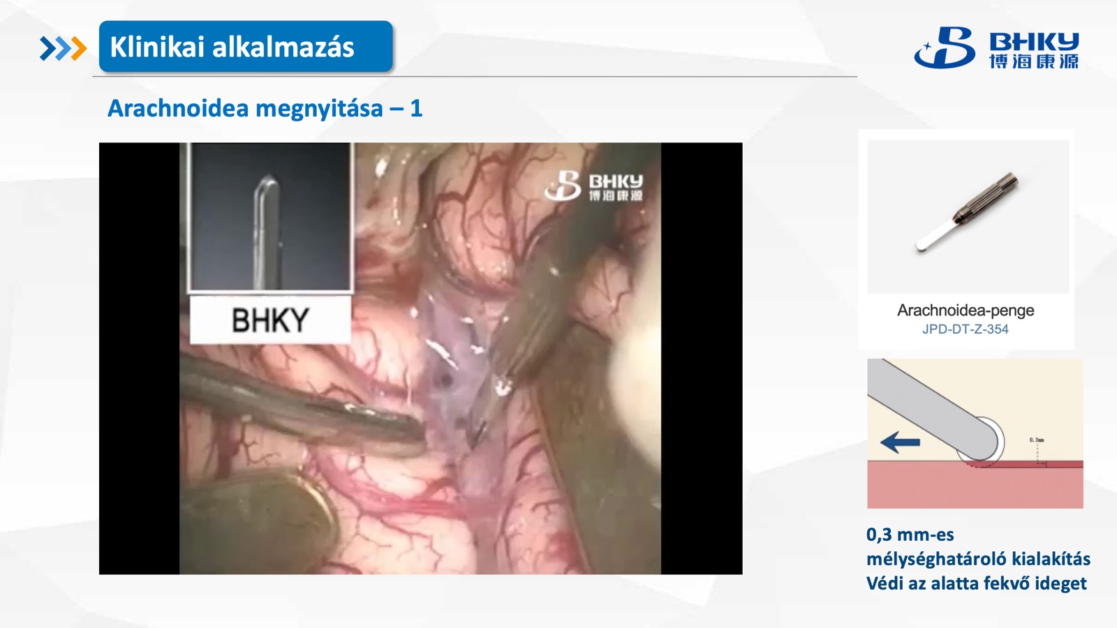 Klinikai alkalmazás — arachnoidea metszés 1