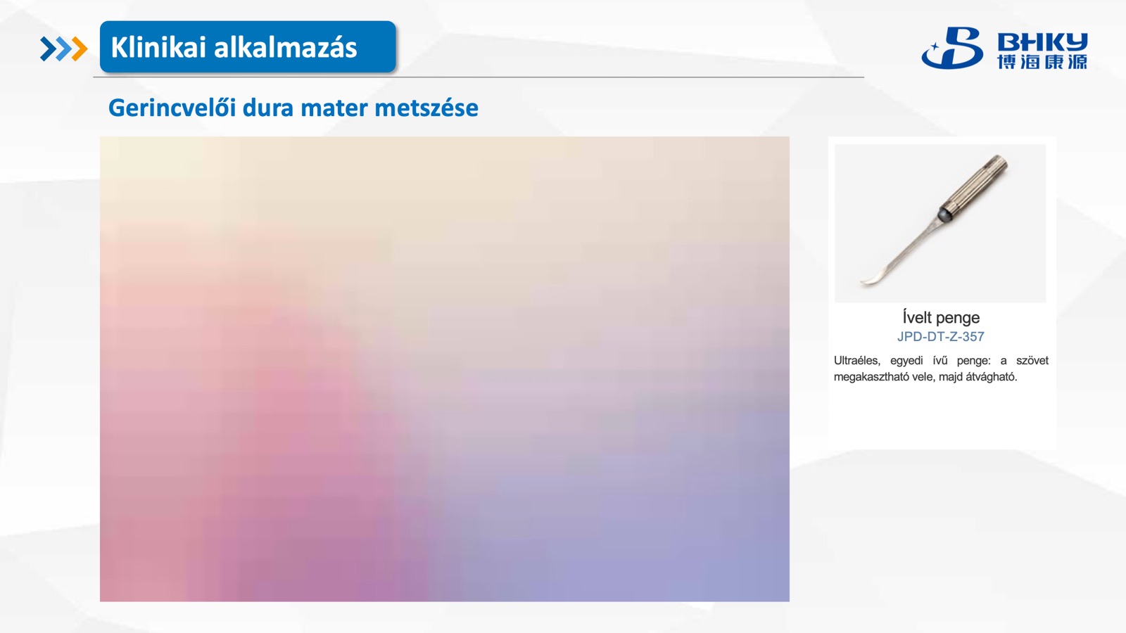 Klinikai alkalmazás — spinalis dura metszés