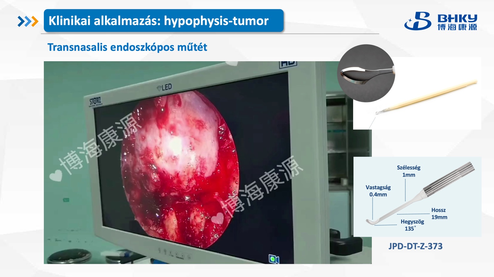 Klinikai alkalmazás — hipofízis tumor, transznazális
